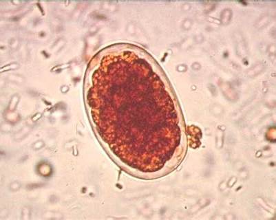 Necator americanus – budowa, cykl życiowy i znaczenie chorobotwórcze