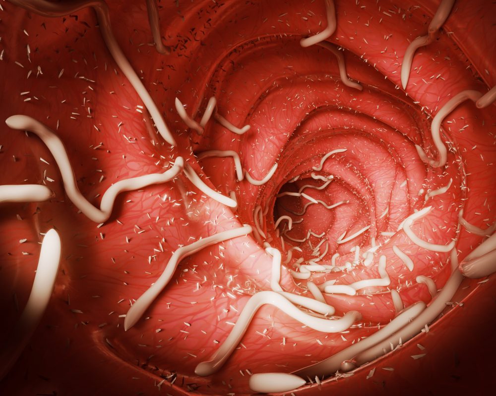 Roundworm parasites in the human intestine. Ascariasis. Diseases of the human digestive system. 3d rendering