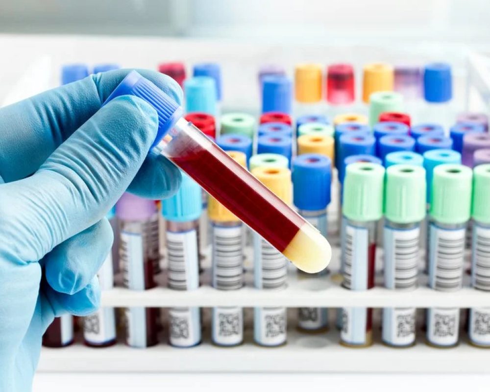 Pakiety badań - laboratorium