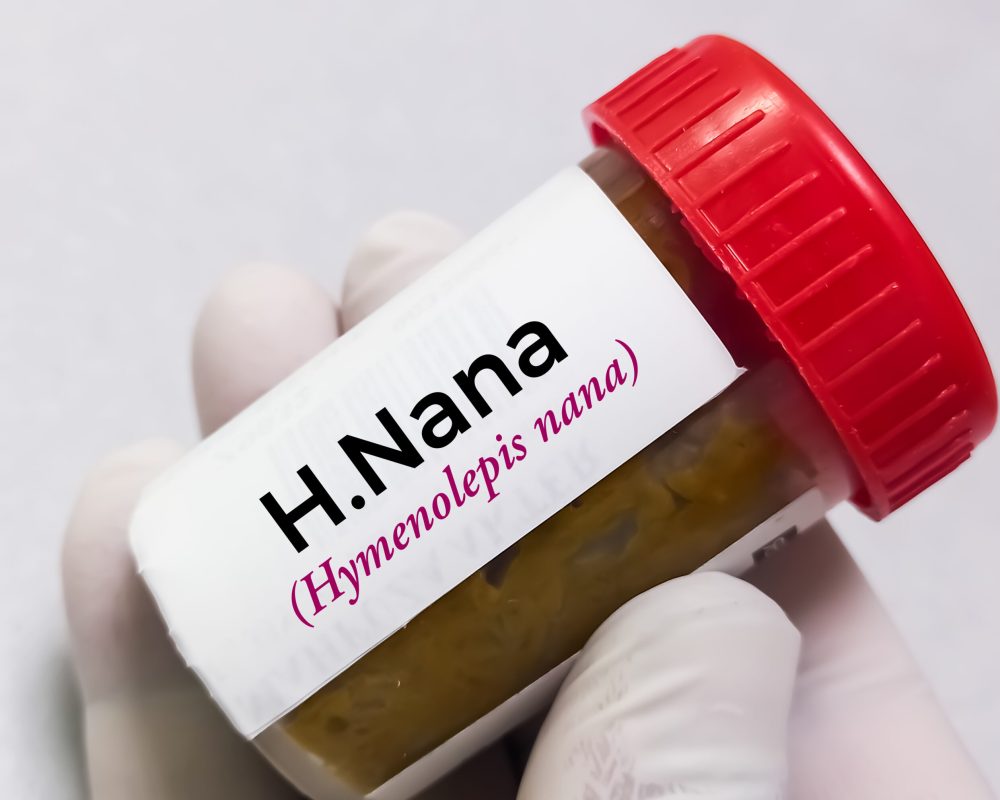 Stool specimen for Hymenolepis nana or H. Nana test.