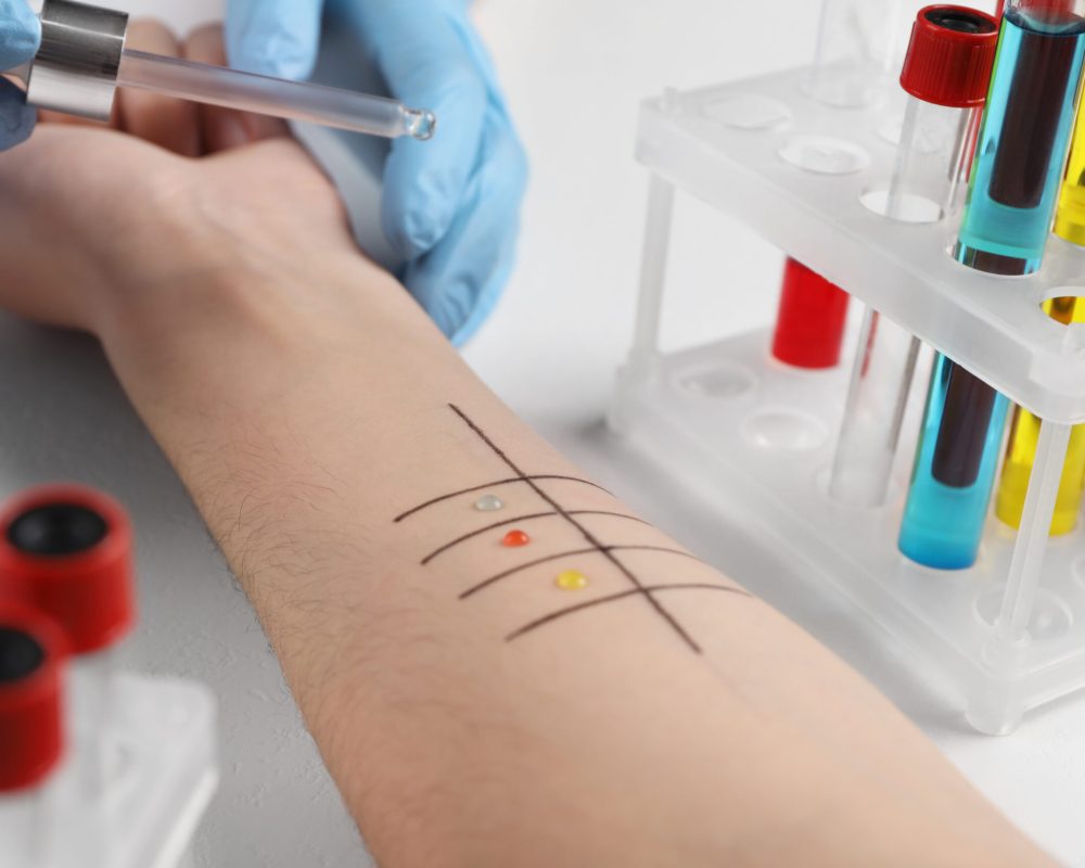 Doctor doing skin allergy test at light table, closeup